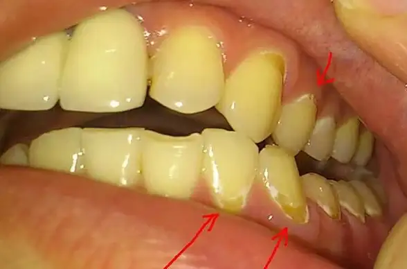🌟科学揭秘🌟微生物探秘🌟细菌最早被识别的神秘有机物究竟是什么？