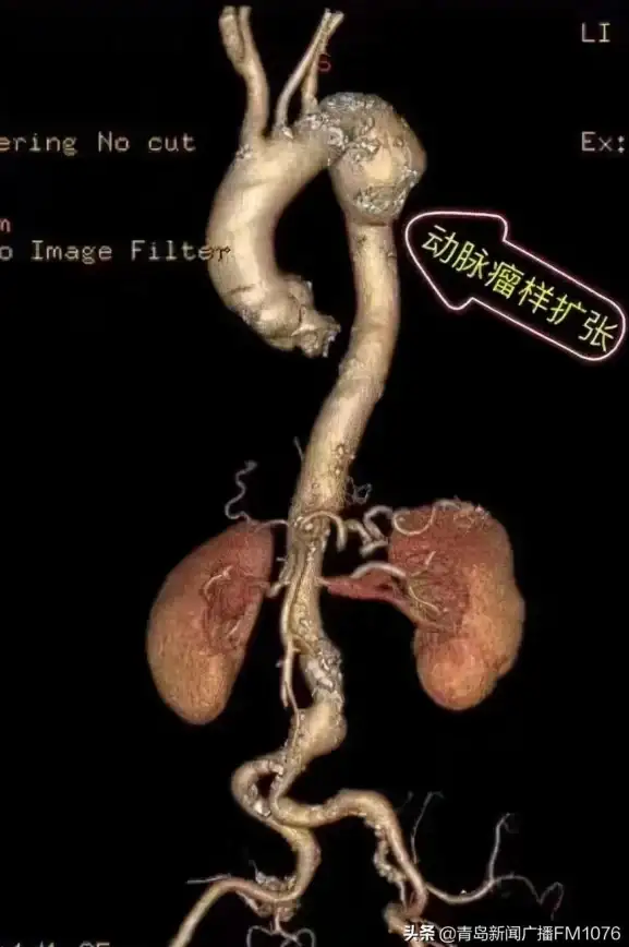 策略秘籍◆高能挑战◆植物搭配 植物大战僵尸杂交版第66关高阶攻略详解！