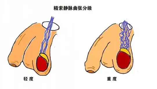 健康指南🔥深夜男科节假日聚会趣味游戏全攻略