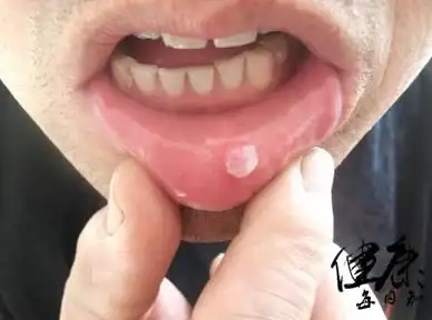 数据库安全|权限管理|数据库权限不足怎么办？解决之道在这里！