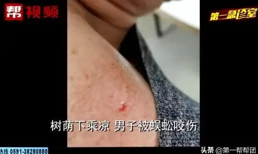★攻略秘籍★实用技巧★毒牙皮肤在王者荣耀中的速成姿势与必备理由揭秘