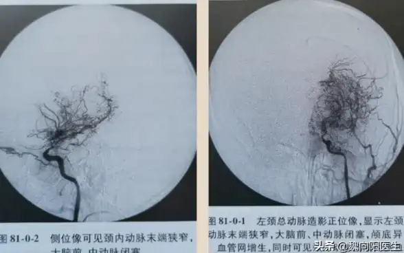 CF技巧🔥穿越火线烟雾头操作全攻略，轻松掌握调整技巧